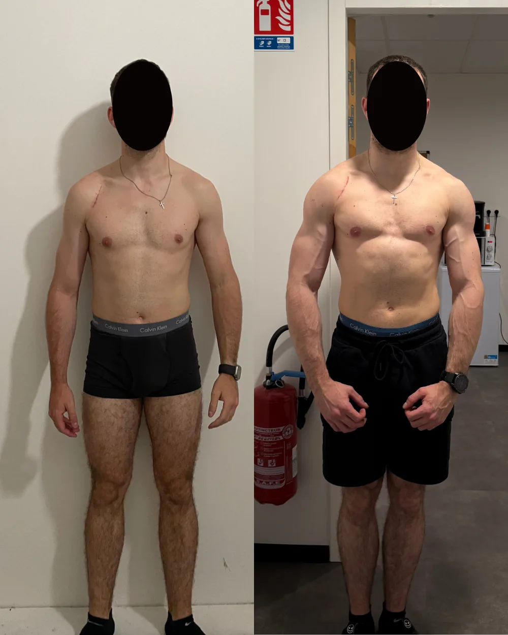 Transformation de Corentin, avant/après, de 72 kg à 80 kg